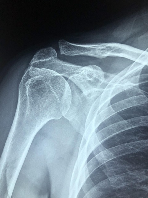 pain-pain-management-body-pain-640x480-58515968.jpeg