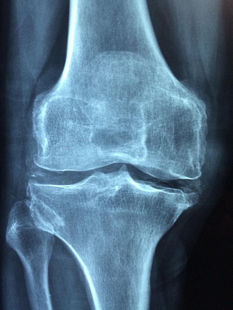 pain, pain management, body pain