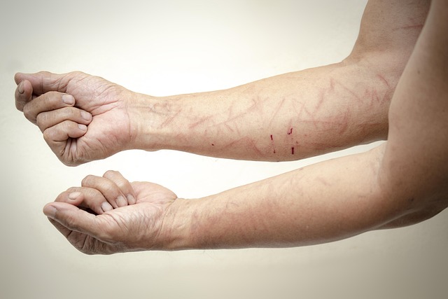 pain-pain-management-body-pain-640x480-19308587.jpeg