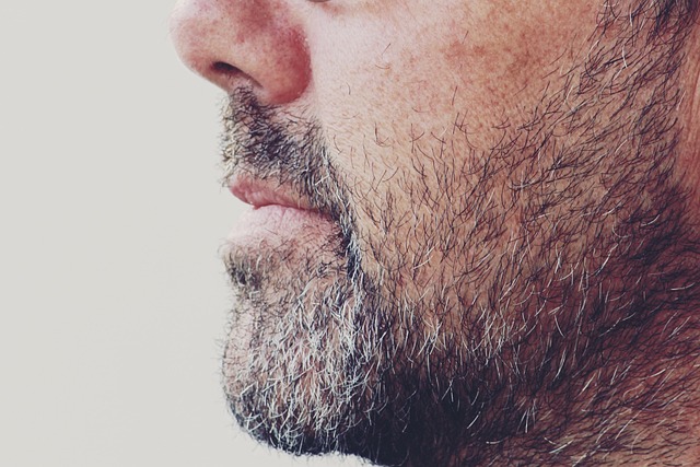 chin-waxing-640x480-87318624.jpeg