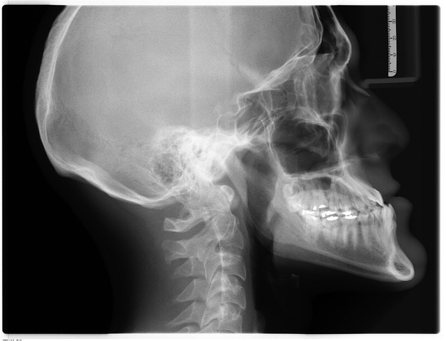 contrast-media-for-x-ray-640x480-81169699.jpeg