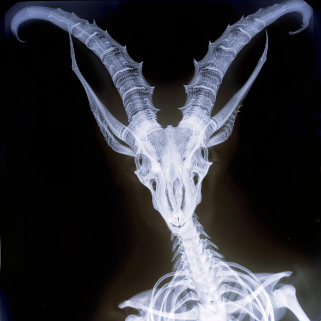 enhanced-x-ray-imaging-640x480-31554037.jpeg