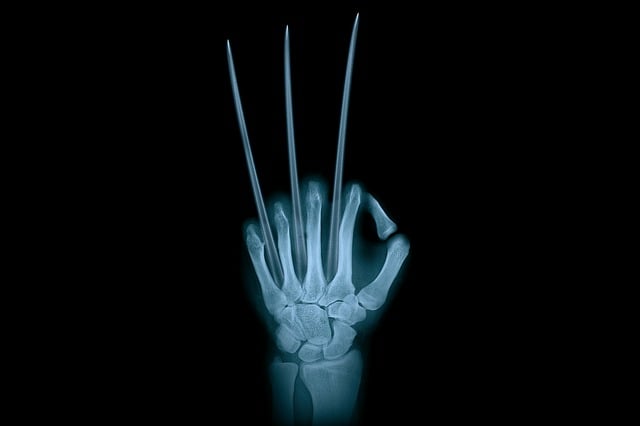 enhanced-x-ray-imaging-640x480-8118340.jpeg