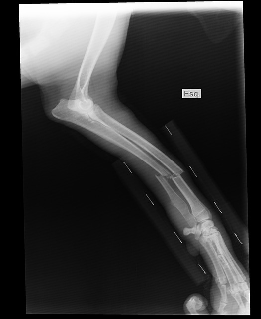 enhanced-x-ray-imaging-640x480-87995326.jpeg