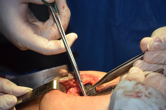 fertility-treatment-after-ovarian-surger-640x480-67374775.jpeg