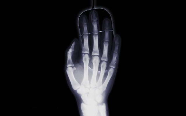 intravenous-contrast-for-x-ray-640x480-47965036.jpeg