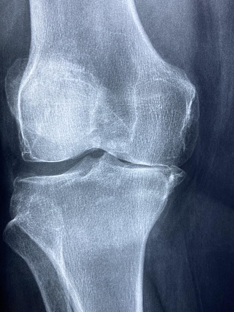 oncological-radiology-640x480-64846162.jpeg