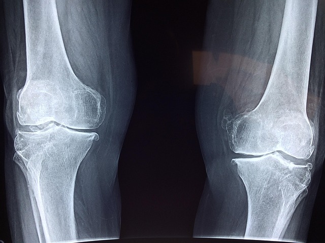 stem-cell-treatment-for-joint-pain-640x480-38736285.jpeg