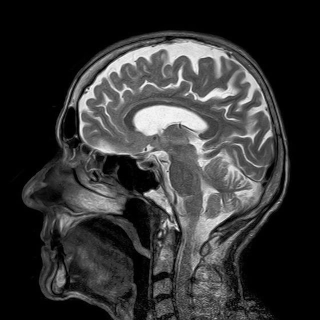 thoracic-mri-640x480-16096214.jpeg