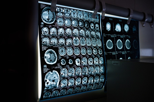 thoracic-mri-640x480-70818584.jpeg