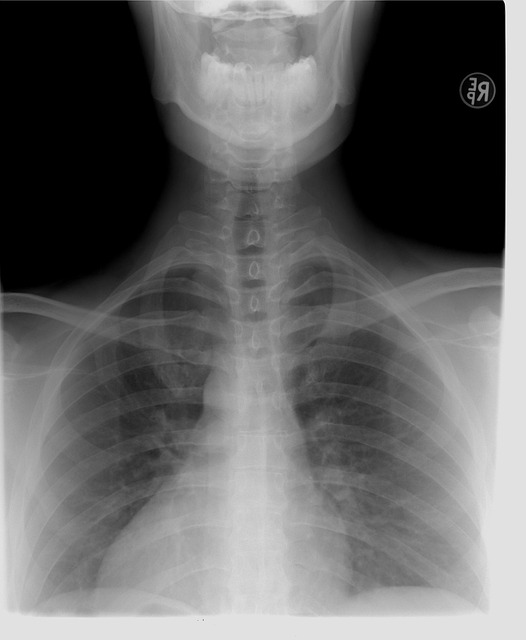 thoracic-mri-640x480-72791845.jpeg