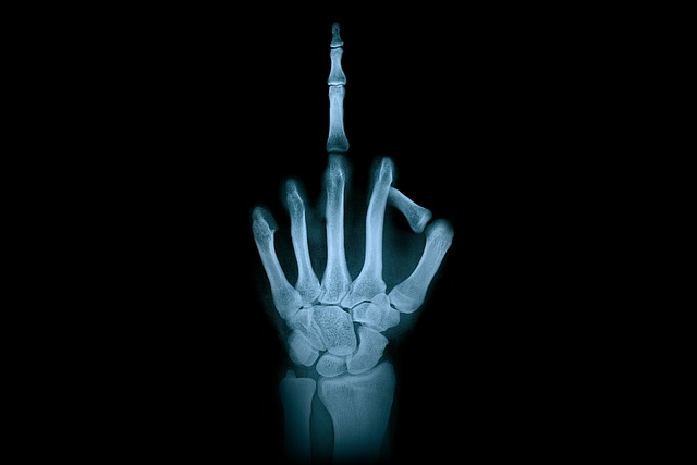 x-ray-contrast-dye-640x480-26194954.jpeg
